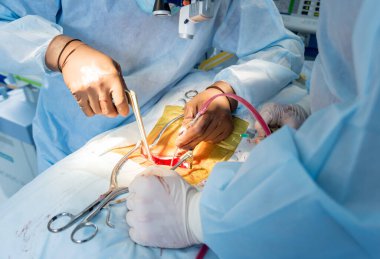 Omurilik ameliyatı. Ameliyathanede ameliyathanede ameliyat aleti olan bir grup cerrah. Laminektomi. Modern tıbbi arka plan