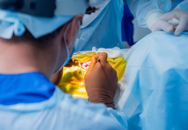 Beyin ameliyatı. Ameliyathanede ameliyat ekipmanlarıyla bir grup cerrah. Modern tıbbi geçmiş