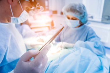 Omurilik ameliyatı. Ameliyathanede ameliyathanede ameliyat aleti olan bir grup cerrah. Laminektomi. Modern tıbbi arka plan