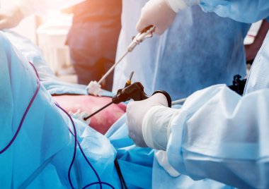 Laparoskopik ekipman kullanılarak yapılan jinekolojik ameliyat. Ameliyathanede ameliyat ekipmanlarıyla bir grup cerrah. Tıbbi geçmiş