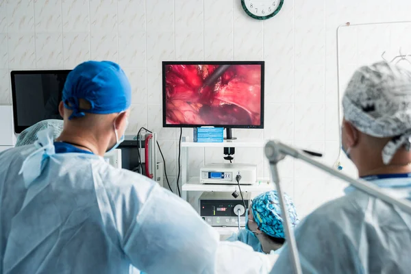 Proces gynekologického chirurgického zákroku za použití laparoskopického vybavení. Skupina chirurgů na operačním sále s chirurgickým vybavením. — Stock fotografie