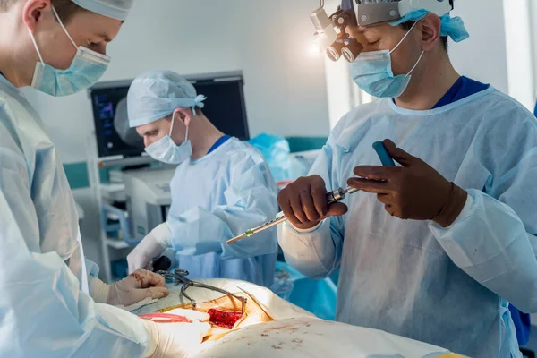 Spinal surgery. Group of surgeons in operating room with surgery equipment. Laminectomy — Stock Photo, Image