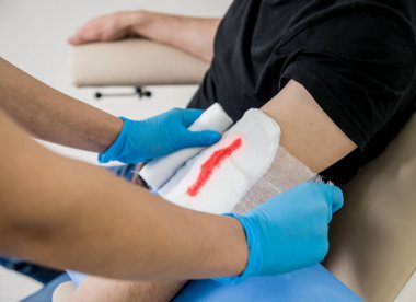 Deri kesiği olan bir hasta için hemşire pansuman yarası. Tıbbi geçmiş