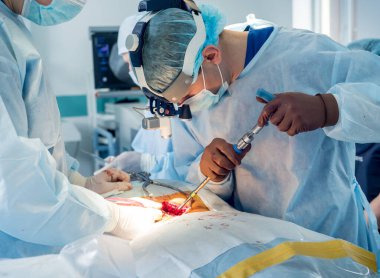 Omurilik ameliyatı. Ameliyathanede ameliyathanede ameliyat aleti olan bir grup cerrah. Laminektomi. Modern tıbbi arka plan