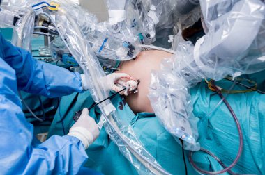 Modern cerrahi sistem. Tıbbi robot. Minimum invazif robotik cerrahi. Tıbbi geçmiş