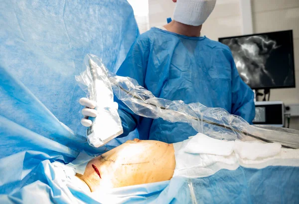 Cerrah göğüs alınırken taşınabilir florasan görüntüleme cihazı kullanıyor.. — Stok fotoğraf