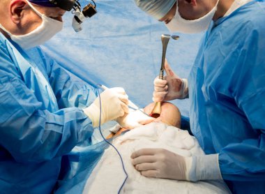 Göğüs kafesini çıkarıp yerine implant takmak için ameliyat..