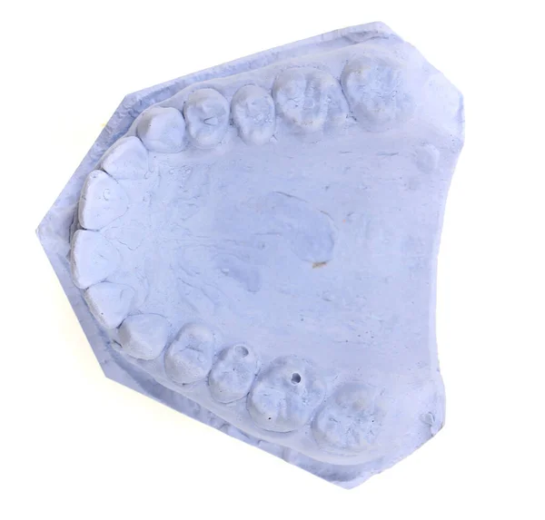 Model Gipsu Zębów Izolowany Białym Tle — Zdjęcie stockowe