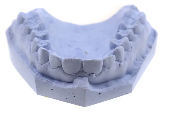 Zuby Sádrovec Model Izolované Bílém Pozadí — Stock fotografie