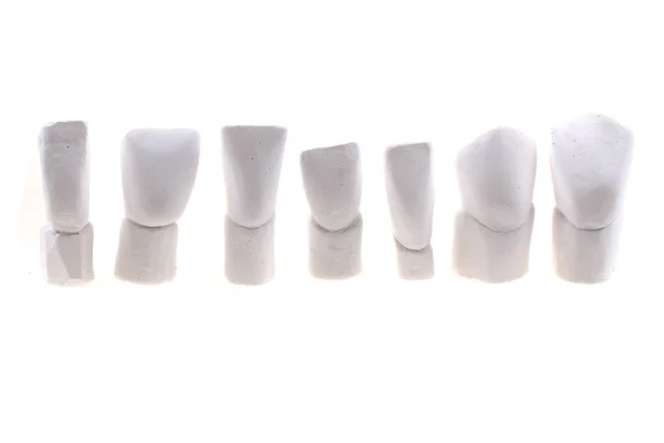 Dents Modèles Gypse Isolés Sur Fond Blanc — Photo