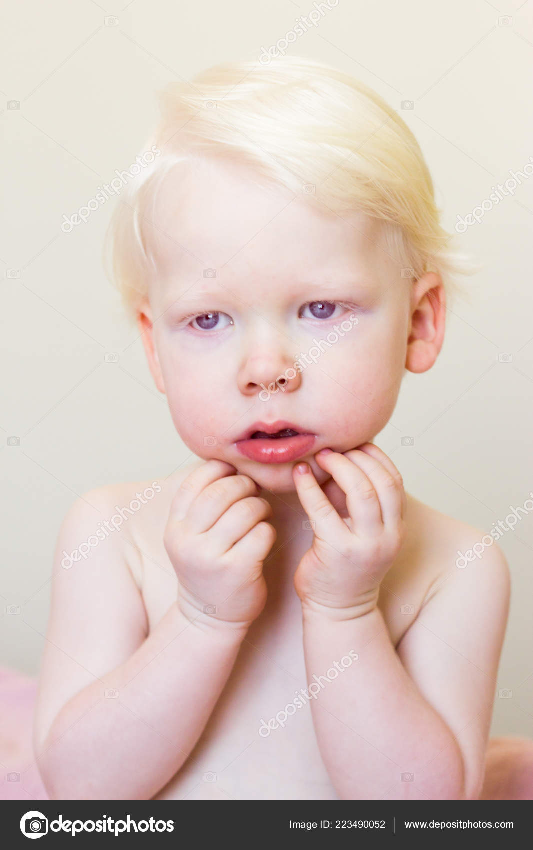 Whitehair babyboy with albinism syndrome on white Stock Photo by ©Iraidka  223490052