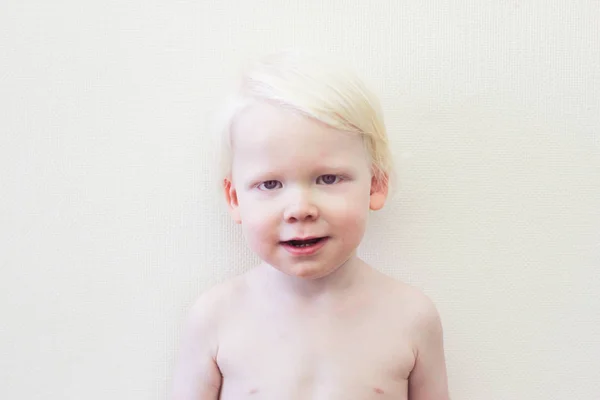Белый мальчик с синдромом альбинизма на белом — стоковое фото