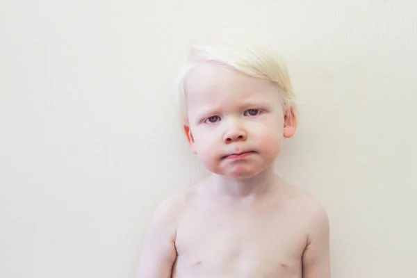 Pelo bianco neonato con sindrome di albinismo su bianco — Foto Stock