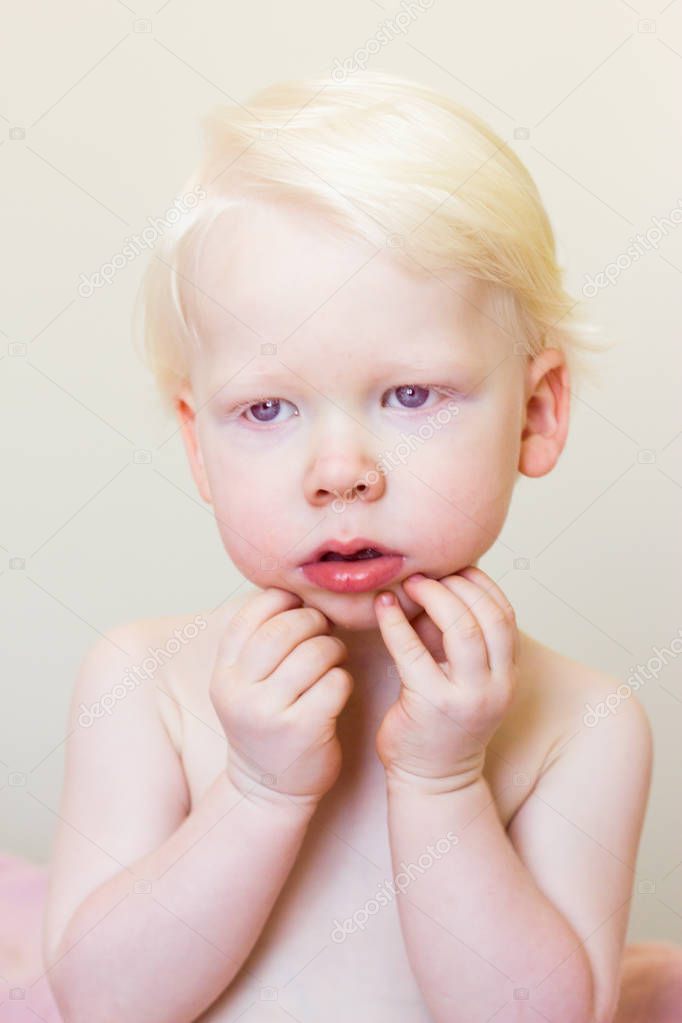 Whitehair babyboy with albinism syndrome on white