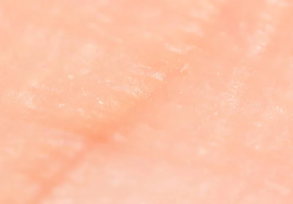 Background of human skin. close — Stock Photo, Image