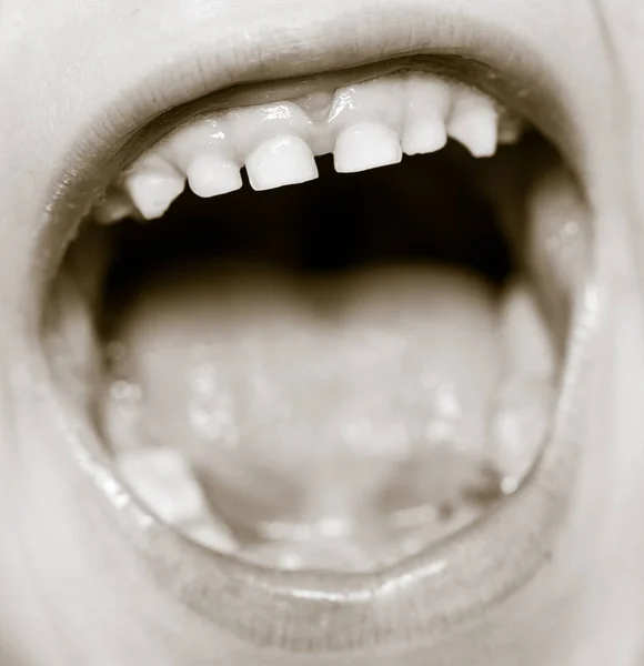 Dentes de leite na boca — Fotografia de Stock