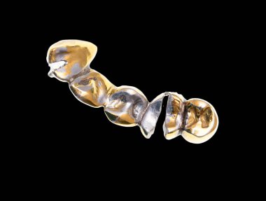 siyah bir arka plan üzerinde metal diş