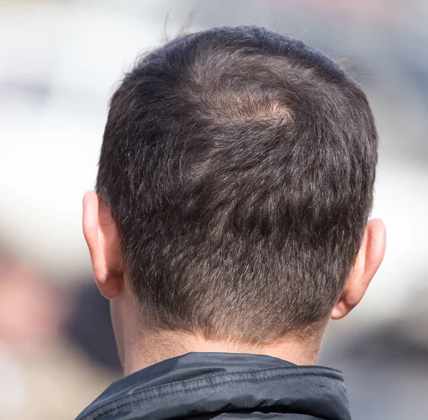 Kopf eines Mannes hinter — Stockfoto