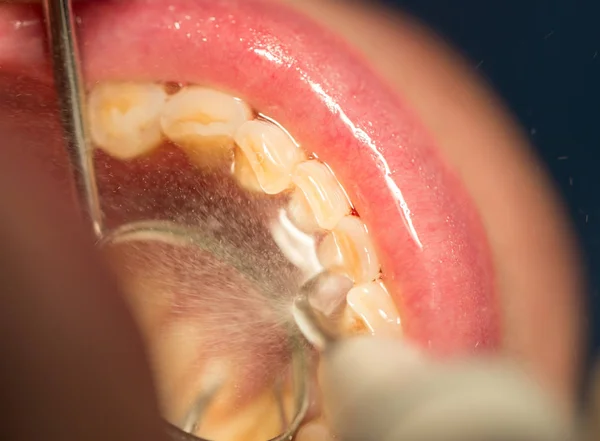 Cure dentistiche in odontoiatria — Foto Stock