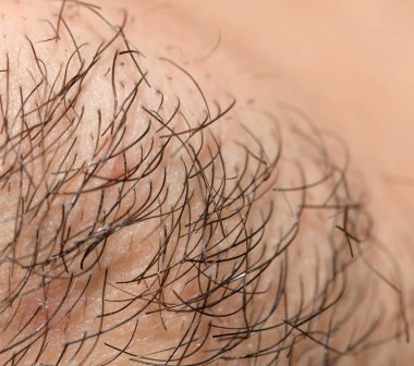 Seven Day Old Beard. Seven day old beard on a Caucasian male. Macro close up. clipart