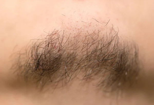 Seven Day Old Beard. Seven day old beard on a Caucasian male. Macro close up. — Stock Photo, Image