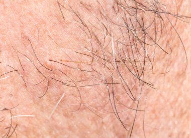 sakal saç. yakın çekim