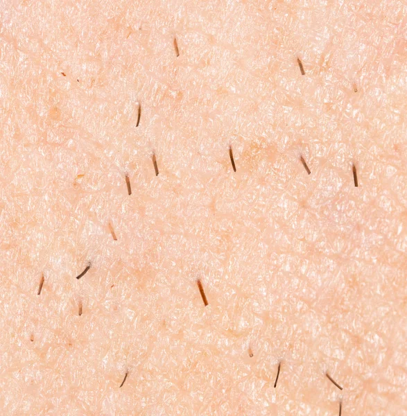 Les poils sur la peau. macro — Photo
