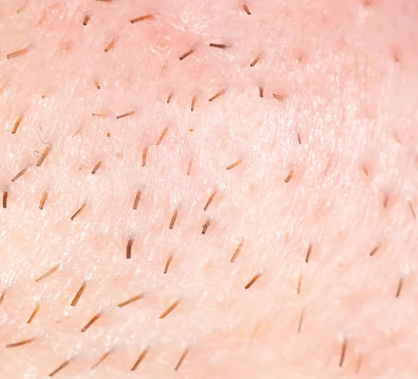 Borsten på huden. makro — Stockfoto