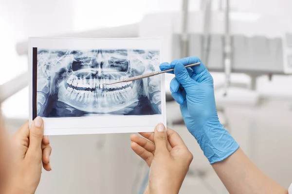 Dentista che mostra l'immagine a raggi X al paziente — Foto Stock