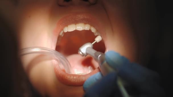 Dentista puliendo los dientes del paciente en el consultorio dental. — Vídeos de Stock