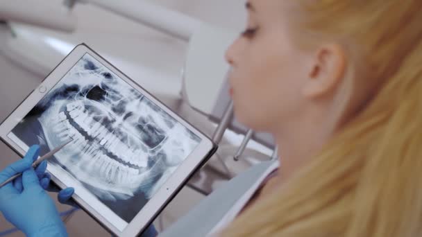 Dentista y paciente eligiendo el tratamiento en una consulta con equipo médico en el fondo — Vídeos de Stock