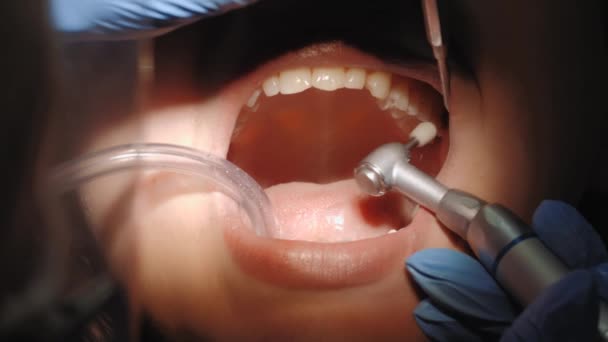 Dentista puliendo los dientes del paciente en el consultorio dental. — Vídeos de Stock