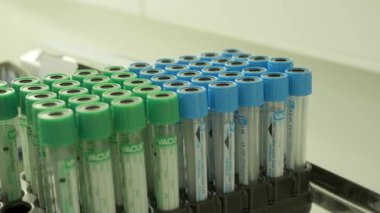 Test tüpleri bir klinik bir kan