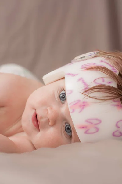 Çünkü onun plagiocephaly bir kask giyen kız