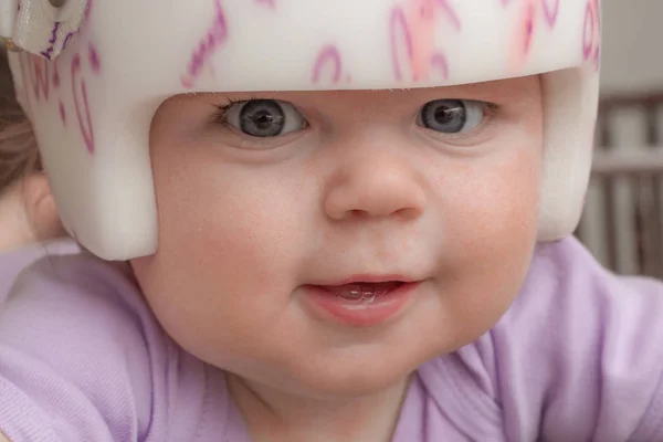 Başının Plagiocephaly Yeniden Şekillendirilmesi Için Kafatası Mödling Kask Takan Genç Telifsiz Stok Fotoğraflar