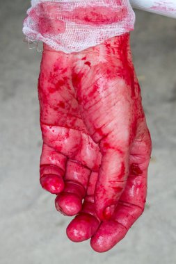 Vişne suyu, kana benziyor.