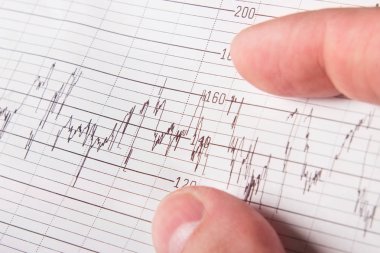 İnsan eli ve tıbbi grafik portre. Tıbbi geçmişi. Klinisyen veya hasta bir kardiyogram elinde tutuyor
