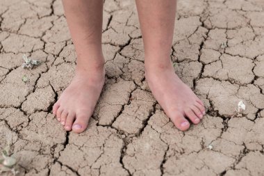 Kurumuş çatlak toprakta bir çocuğun çıplak ayakları. Su eksikliği kavramı, susuzluk.
