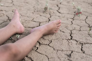 Isıdan bayılma, bir çocukta susuzluk. Çocukların ayakları çatlamış kurumuş toprağa uzanıyor.
