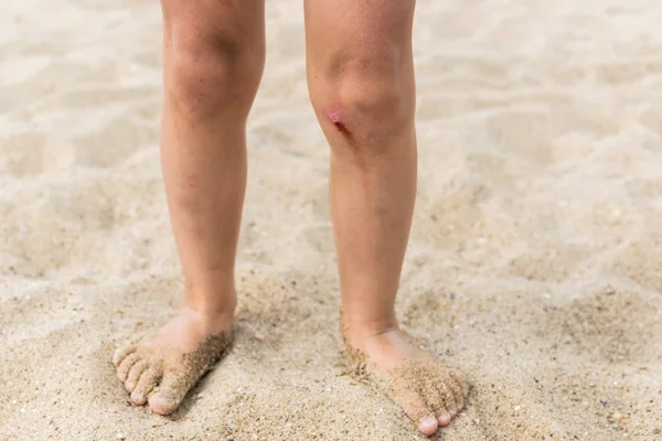 Las rodillas gastadas llevaban a un niño pequeño parado en la arena. La sangre proviene de una pequeña herida . —  Fotos de Stock