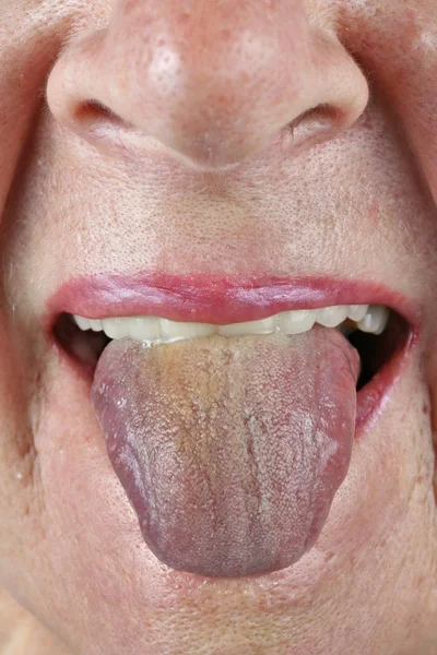 An elderly senior woman with metal- ceramic  teeth shows his ton — Stock Photo, Image