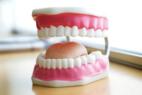 Close Van Grote Kunstmatige Tandheelkundige Model Met Tong Tafel Het — Stockfoto