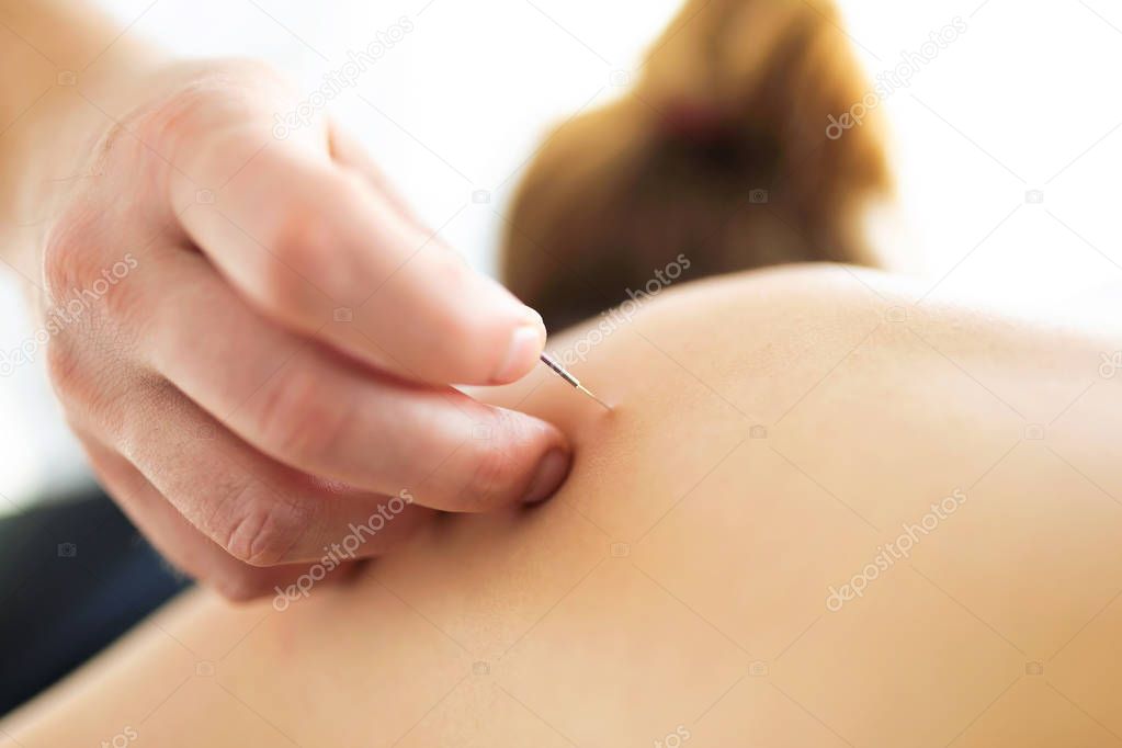 Young physiotherapist doing a trigger point injection in patient back.