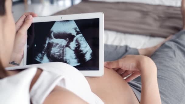 Video Una Hermosa Mujer Embarazada Joven Mirando Ultrasonido Bebé Una — Vídeo de stock