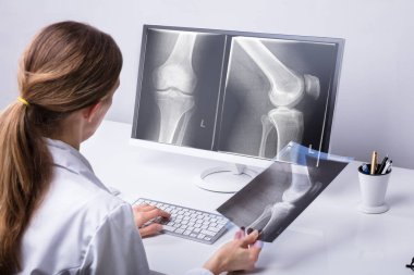 Olgun kadın doktor diz röntgen Kliniği incelenmesi