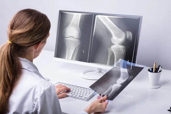 Ärztin Untersucht Knie Röntgen Klinik — Stockfoto