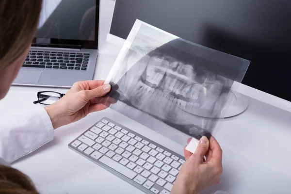 Nahaufnahme Der Hand Eines Zahnarztes Der Zähne Röntgt — Stockfoto