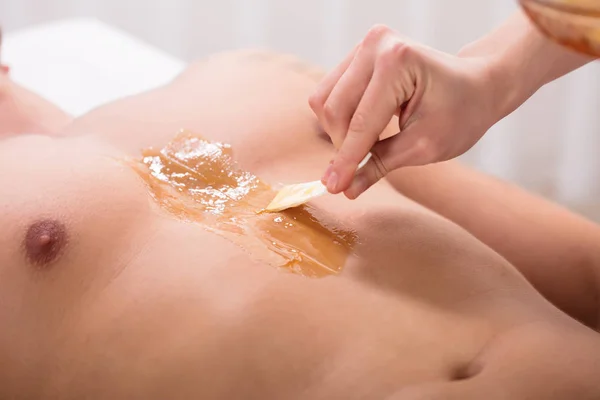 Close-up Of Beautician\'s Hand Applying Wax On Man\'s Chest In Spa