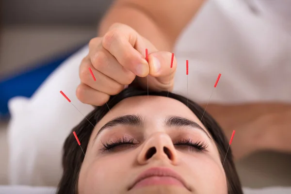 Schöne Junge Frau Bekommt Akupunktur Behandlung Beauty Spa — Stockfoto