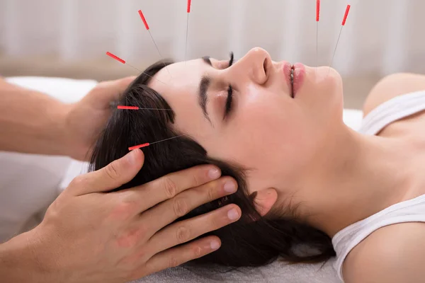 Ontspannen Jonge Vrouw Acupunctuur Behandeling Krijgen Beauty Spa — Stockfoto
